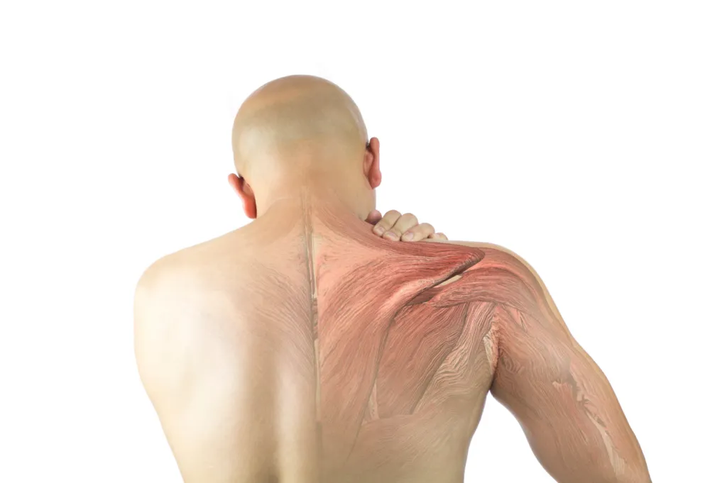 Anatomical illustration of the upper back and shoulder muscles seen from behind