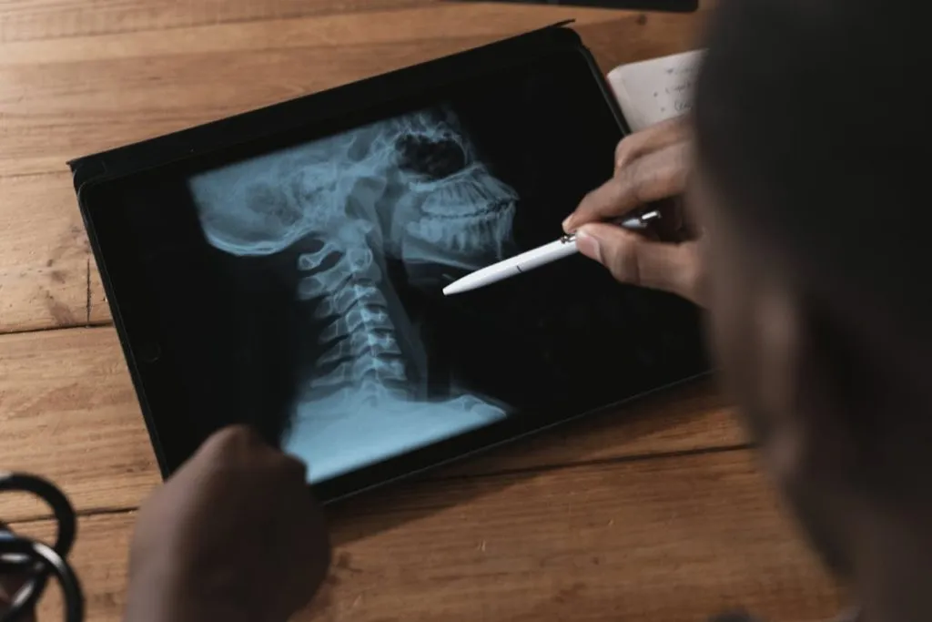 Doctor pointing a pen at a skull and neck x-ray displayed on a tablet