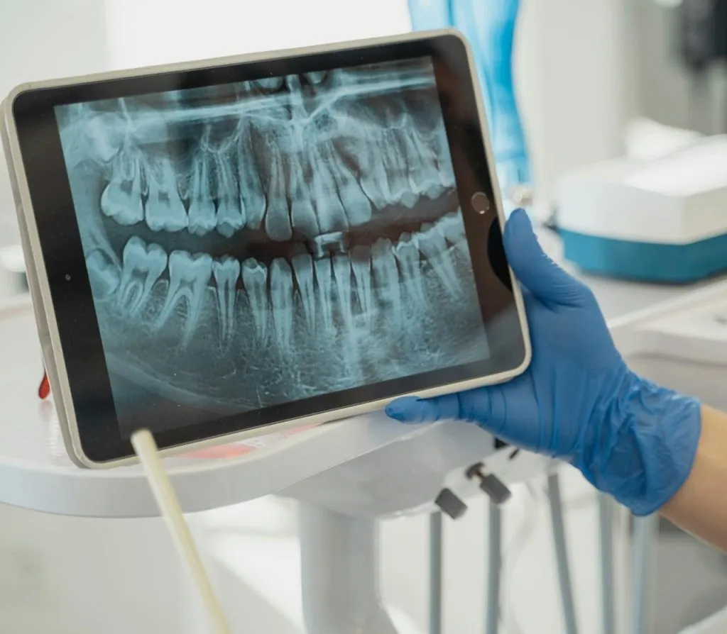 Dentist in blue gloves holding a tablet showing a dental x-ray