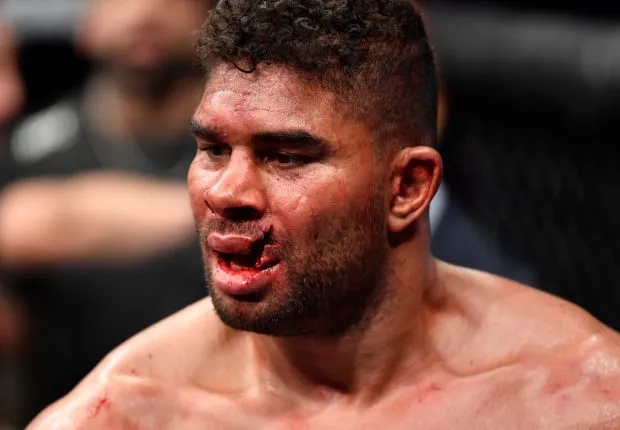 Close-up of a fighter with a badly split lip after a bout